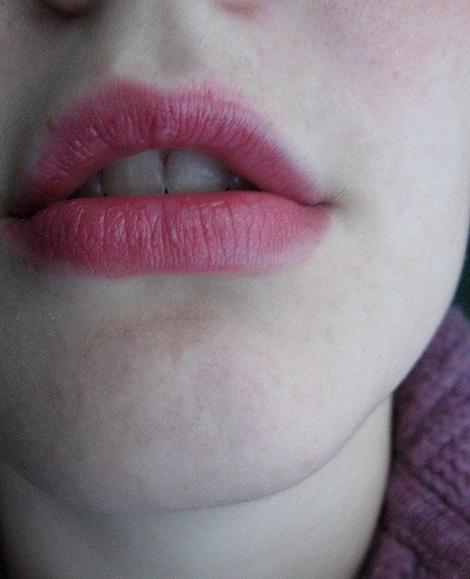 Lips