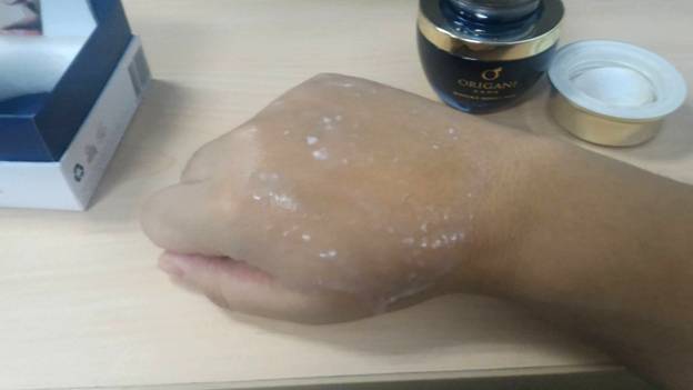 Gel Application on the Back of the Hand